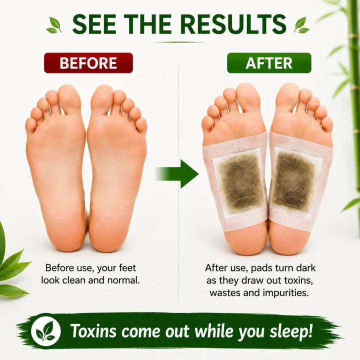 Kiyome Kinoki Detox Foot Patches